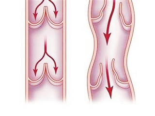 阿里巴巴:4949澳门开奖免费大全-静脉曲张有什么症状