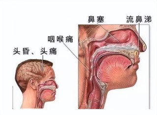 火山视频:澳门三期必内必中一期-鼻炎和鼻窦炎有什么区别