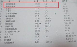 小红书:2024新澳门资料大全正版资料免费-谷草转氨酶是什么