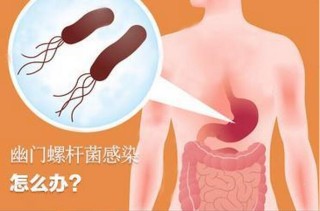 网易:澳门资料大全 正版资料查询-幽门螺杆菌是什么原因引起的