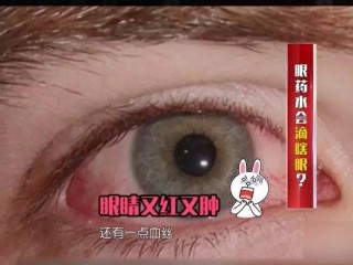 中新网:澳门一肖一码一必开一肖-眼睛充血用什么眼药水