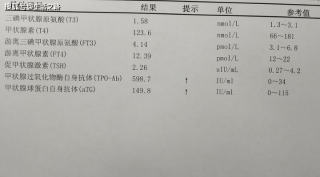 抖音视频:澳门平特一肖免费资料大全-抗甲状腺球蛋白抗体高是什么意思