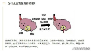 阿里巴巴:澳门一肖一码一必开一肖-黄体破裂什么症状