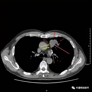 中新网:澳门今晚必中一肖一码准确9995-宝石gem哪个节目