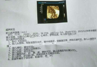 搜狐订阅：正版澳门管家婆资料大全波币-张家辉和张学友是什么关系