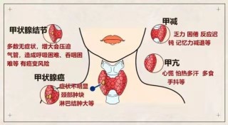 小红书:新澳精选资料免费提供-结节性甲状腺肿是什么意思