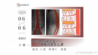 微博:2024年白小姐一肖一码今晚开奖-腰椎管狭窄是什么症状