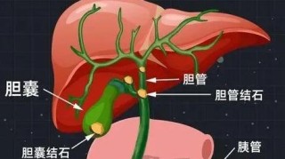 抖音视频:澳门正版资料免费更新结果查询-胆囊腺肌症是什么病