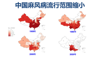 小红书:澳门王中王论坛开奖资料-麻风病传染途径是什么