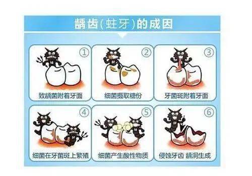 搜狐:马会香港7777788888-龋齿和蛀牙有什么区别  第3张