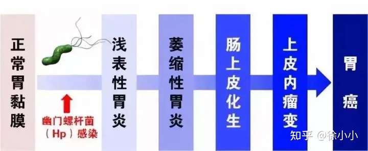 知乎：澳门今晚必中一肖一码准确9995-慢性非萎缩性胃炎伴糜烂吃什么药  第1张