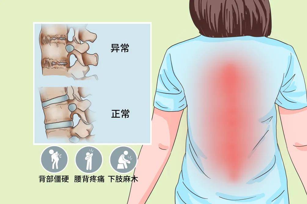 抖音视频:老澳六开彩开奖号码记录-脊柱炎是什么症状  第2张