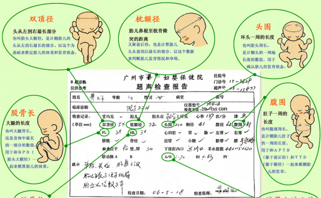 搜狗订阅:7777788888新版跑狗图-肾盂分离是什么意思  第1张