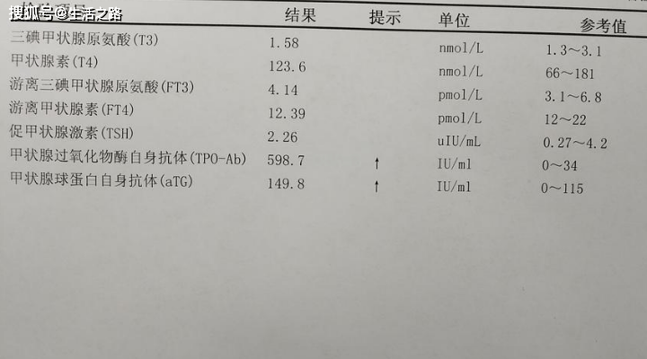 抖音视频:澳门平特一肖免费资料大全-抗甲状腺球蛋白抗体高是什么意思  第1张